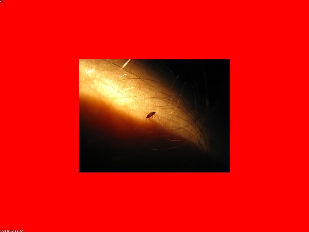 សំណួរញឹកញាប់